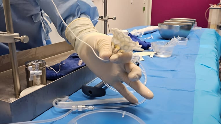 Chirurgie cardiaque : une solution révolutionnaire pour les patients non opérables