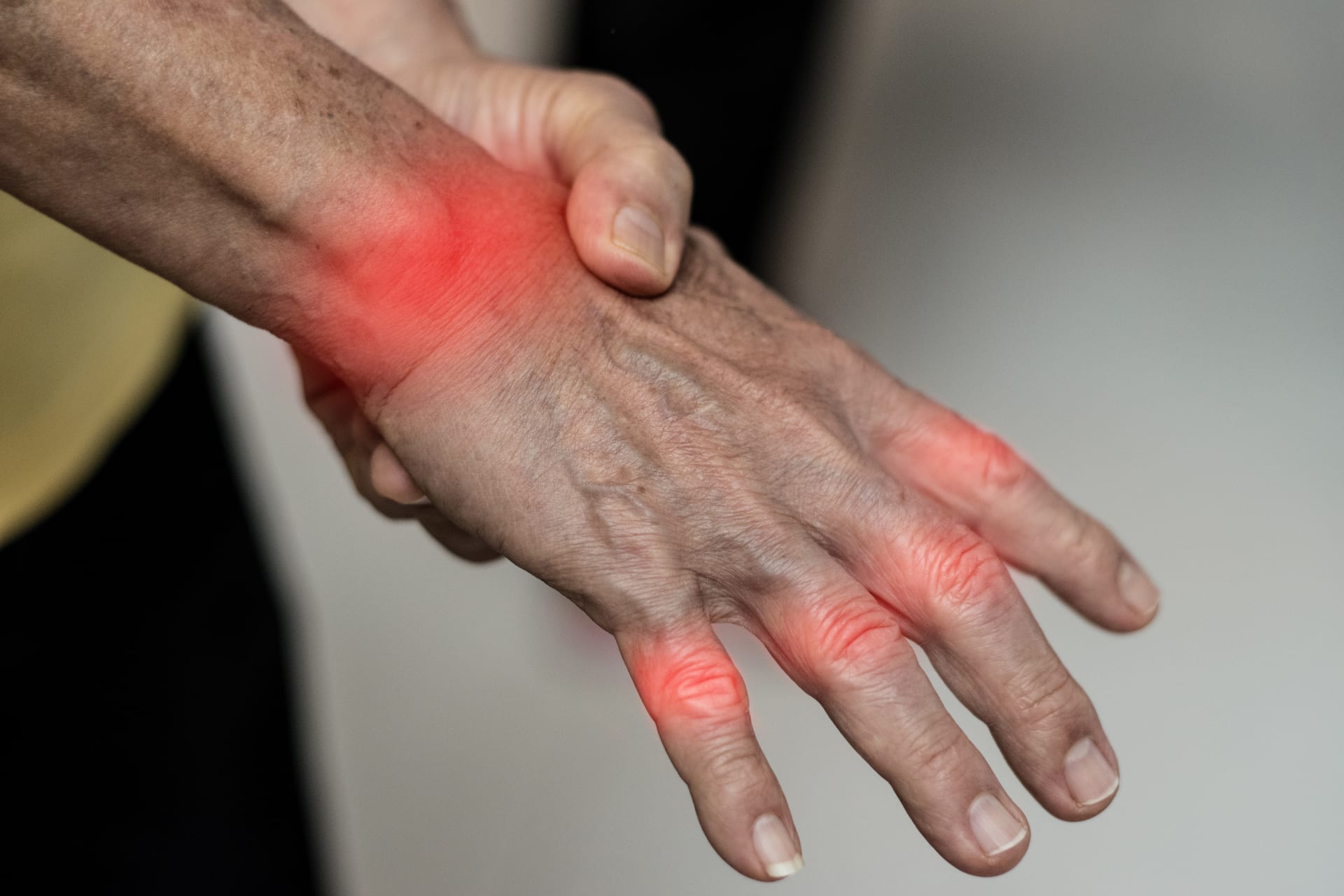 Rhumatismes inflammatoires chroniques