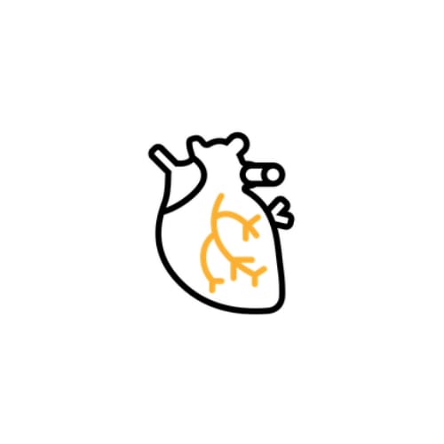 Cardiologie interventionnelle