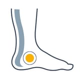 Chirurgie du pied et de la cheville