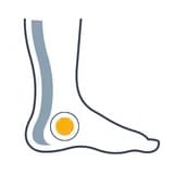 Chirurgie du pied et de la cheville