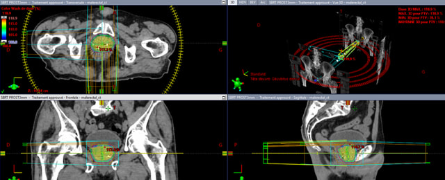 📢 𝐍𝐨𝐮𝐯𝐞𝐥 𝐞𝐬𝐬𝐚𝐢 𝐜𝐥𝐢𝐧𝐢𝐪𝐮𝐞 𝐚̀ 𝐥’𝐈𝐂𝐏𝐍 !