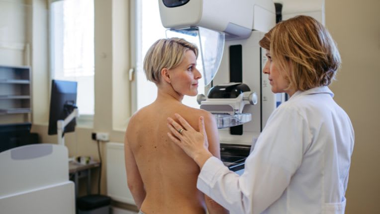 Dépistage du cancer du sein : solutions pour améliorer la participation des femmes