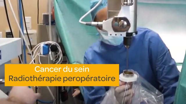 Cancer du sein --> Radiothérapie peropératoire