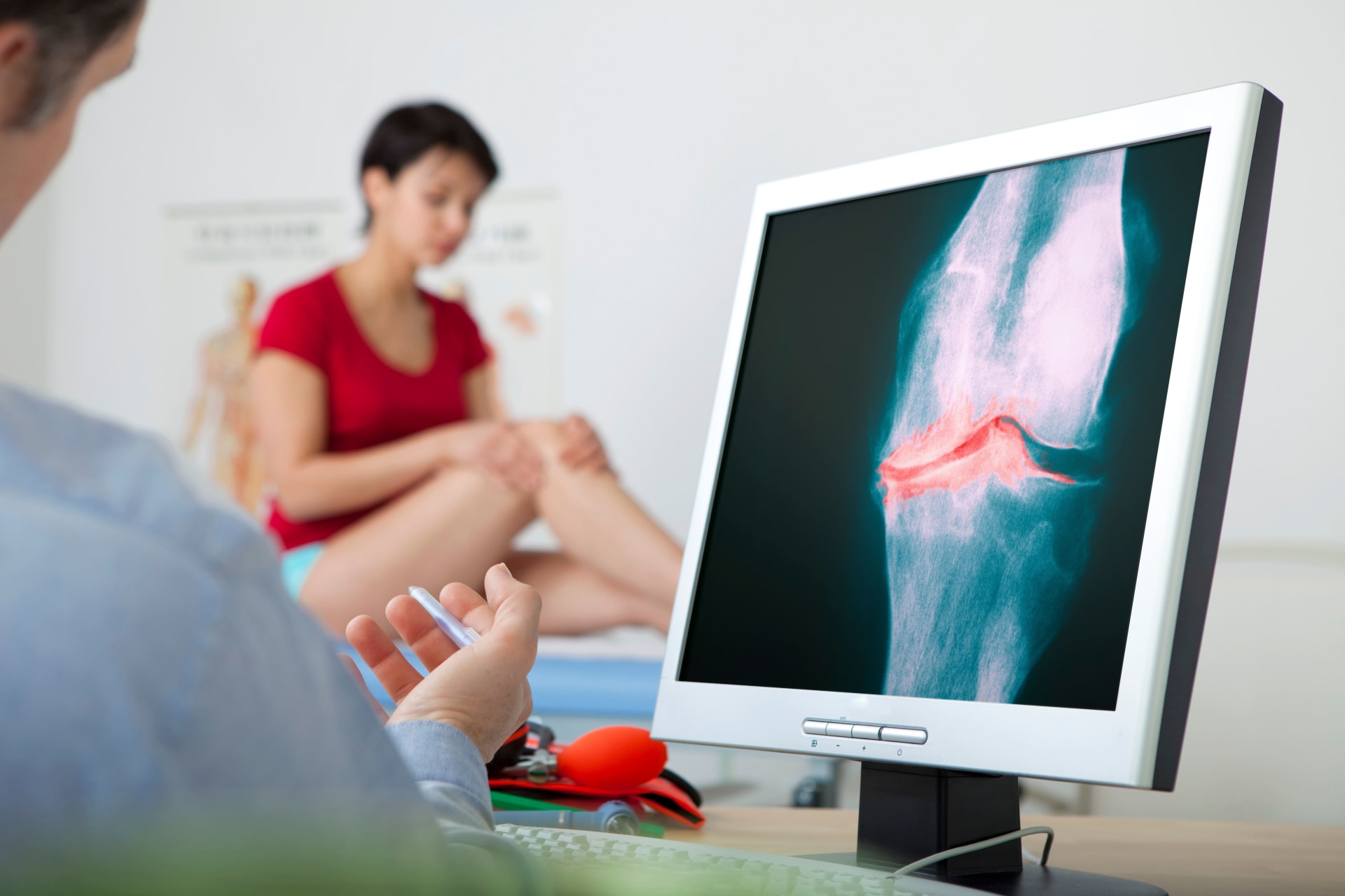 Image pour Illustrer la Rupture du Ligament Croisé Antérieur