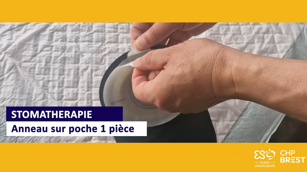 Pose anneau sur poche 1 pièce