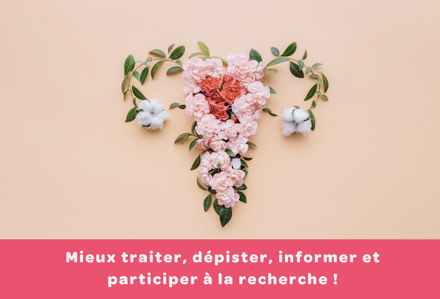 Qu'est-ce que l'endométriose ?