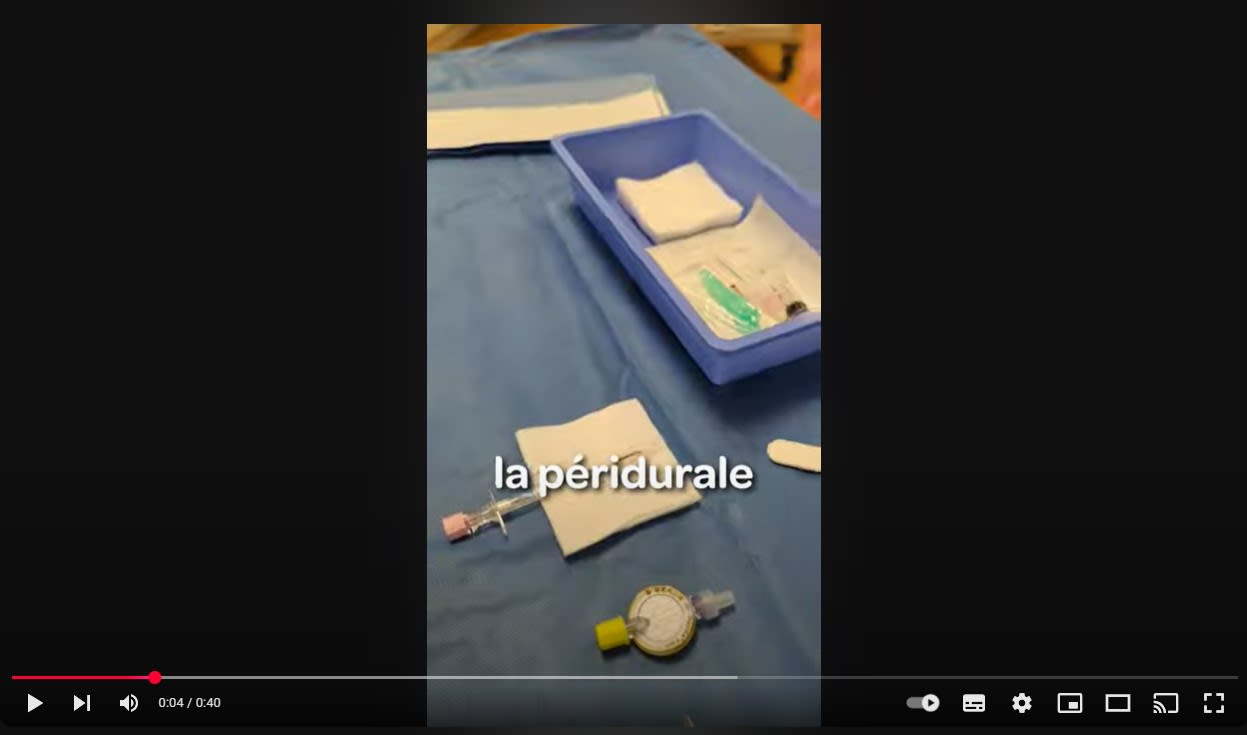 La péridurale comment ça marche ?