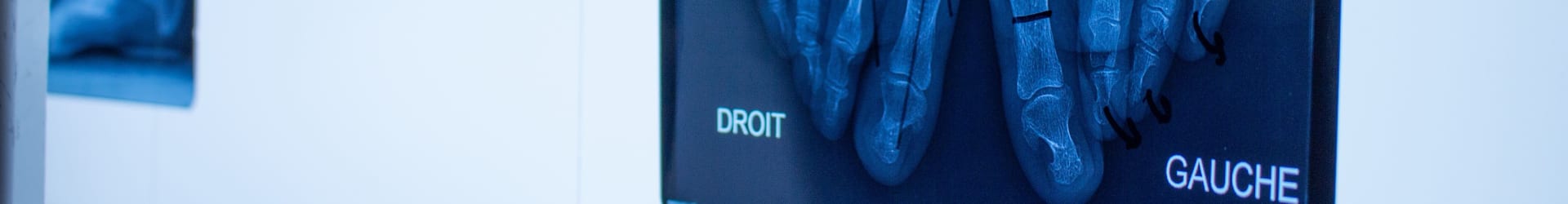 Pôle de la Cheville et du Pied