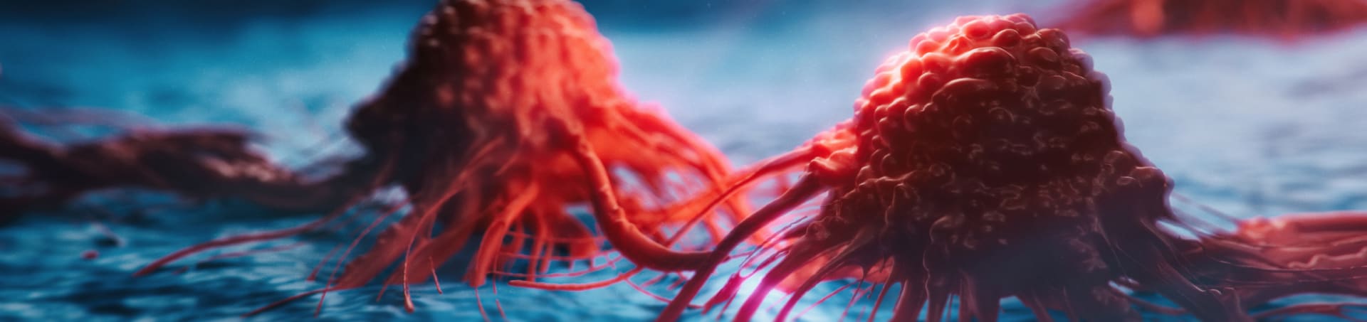 Parcours cancérologie