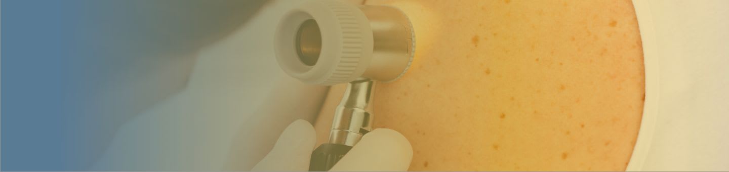 Dermatite atopique (eczéma)