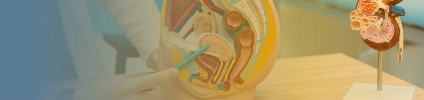 Advanced treatment for urinary stones in France