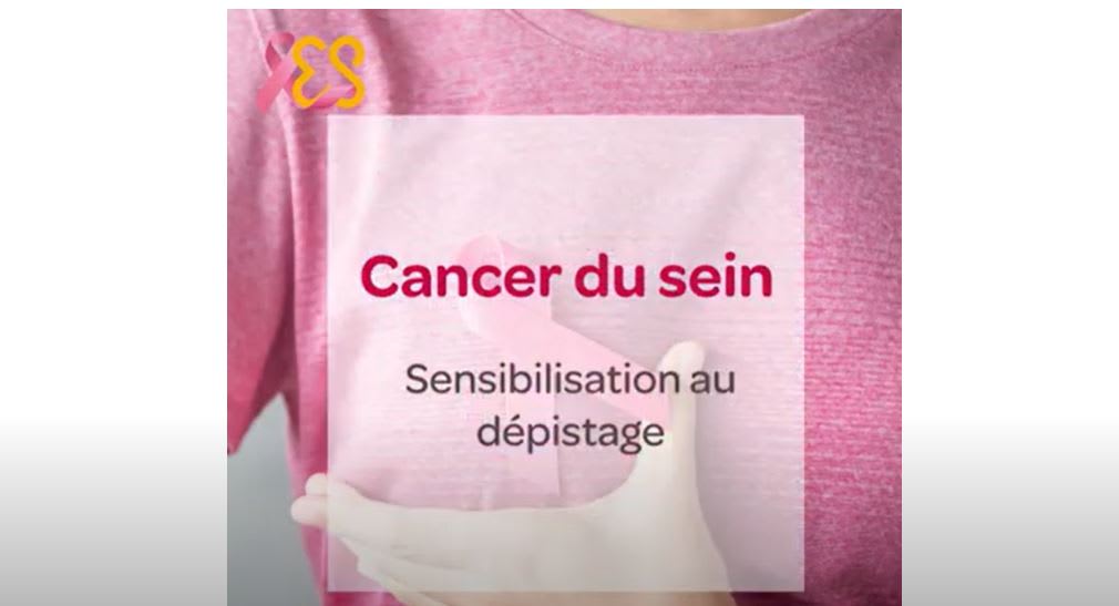 Le dépistage du cancer du sein