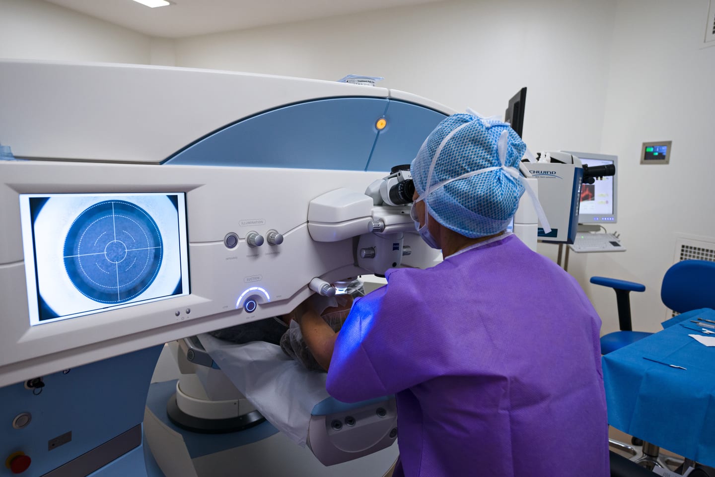 Chirurgie réfractive