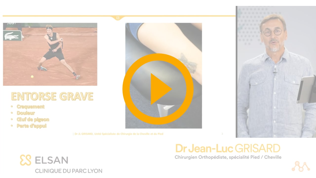 La RAAC après une ligamentoplastie au frondiforme