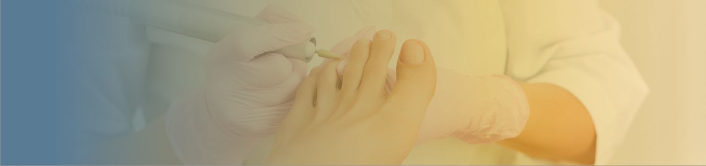 Les maladies des pieds