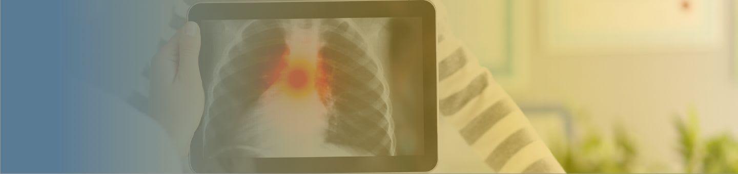 Symptômes de pneumonie