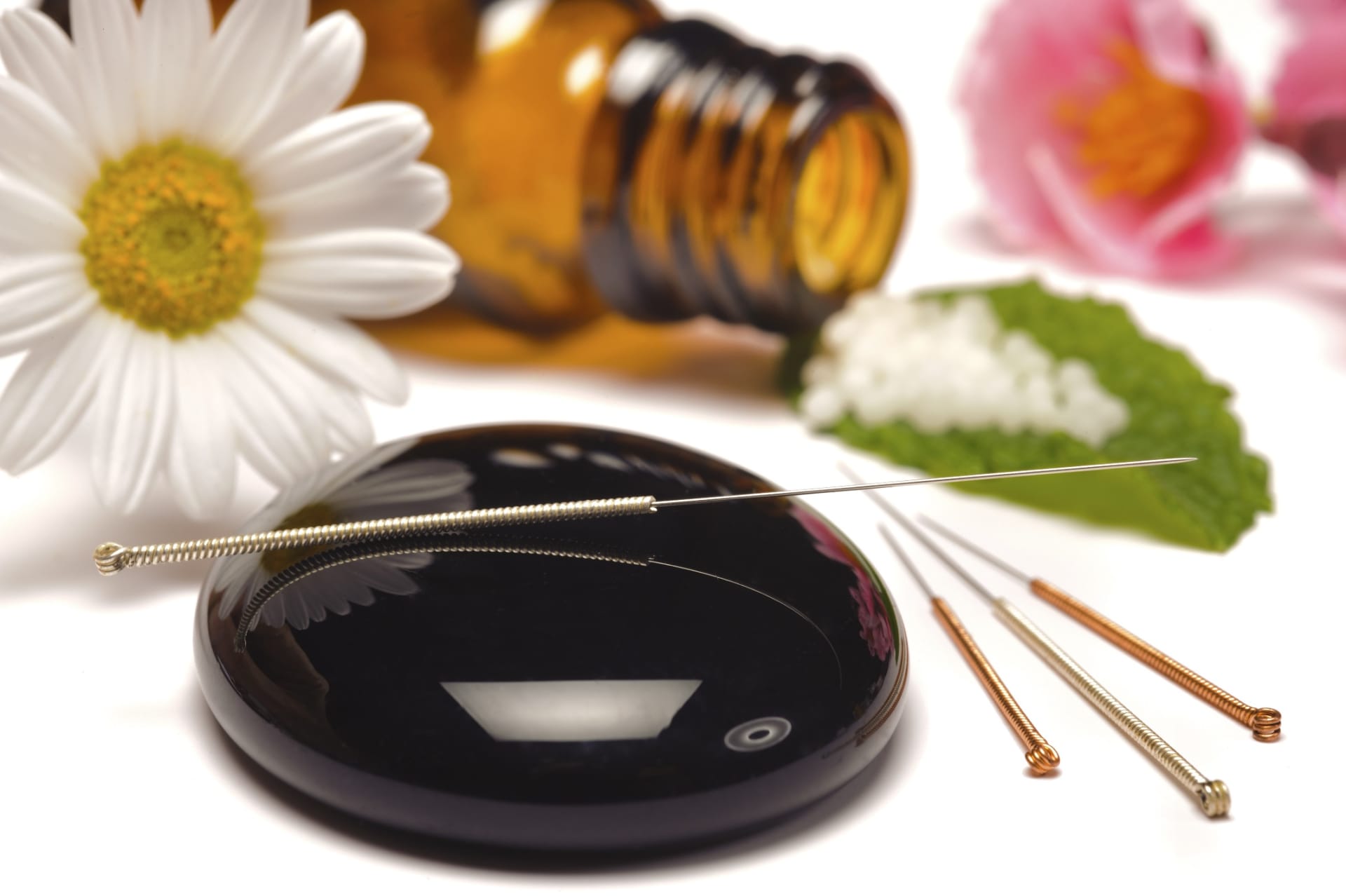 Qu’est-ce que l’acupuncture ?