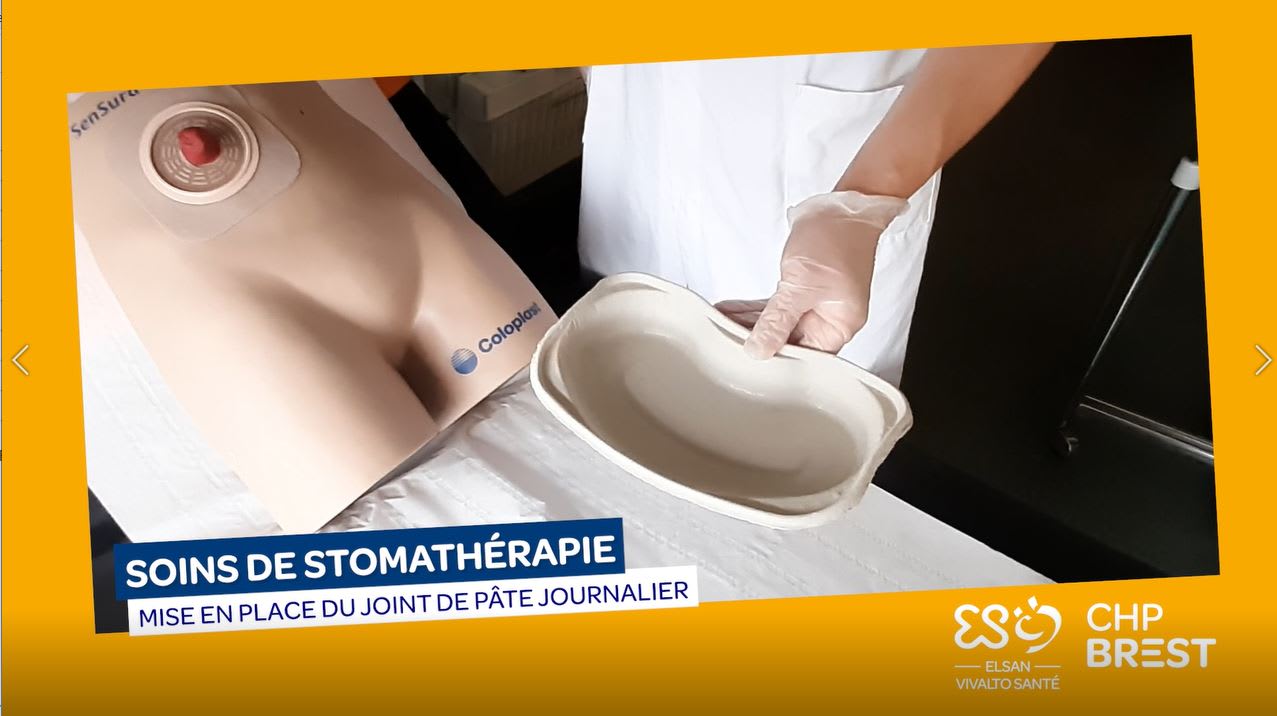 Mise en place du joint de pâte journalier