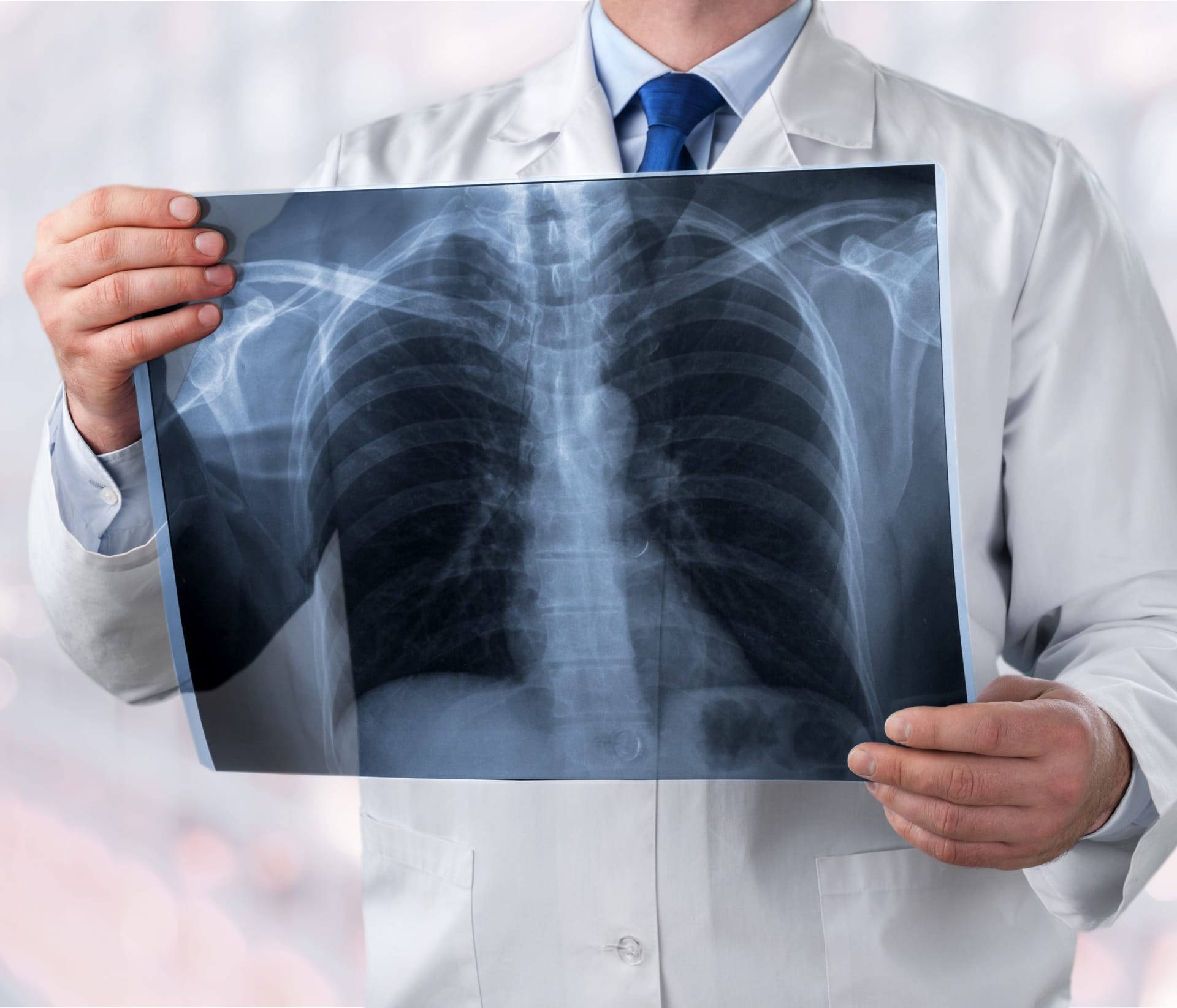 Imagerie Médicale