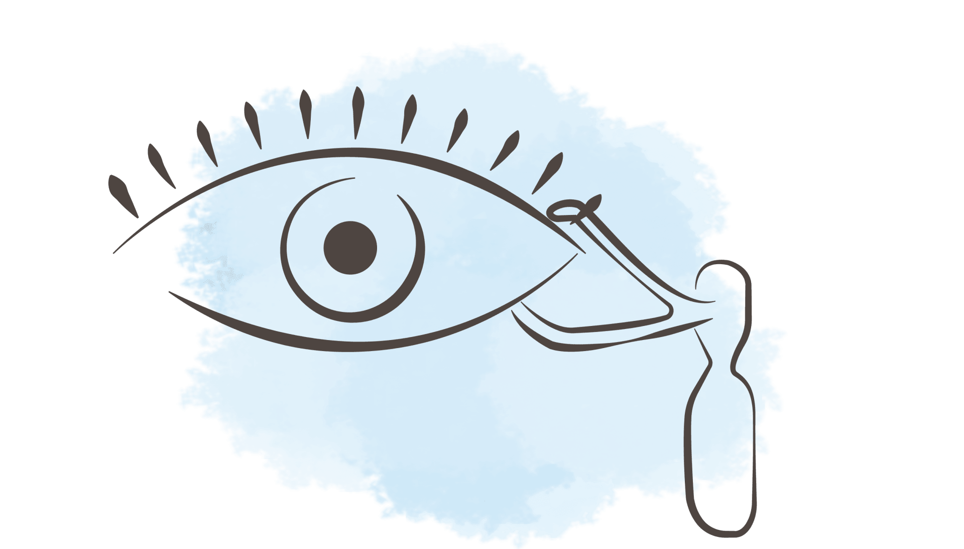 Le Sondage des voies lacrymales