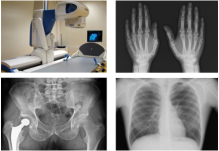 Clichés de radiographie générale