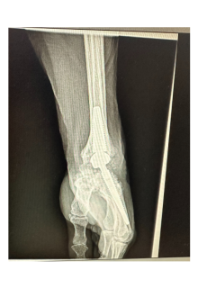 Prothèse de poignet