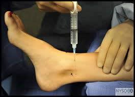 hallux 2