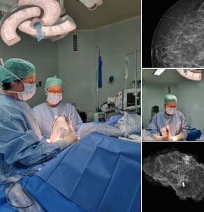dr pirlet cancer sein elsan
