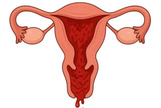 Illustration utérus en période re règle