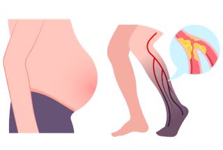 illustration du ventre et du pied droit pour même en avant les partie du corps qui subissent souven la rétention d'eau