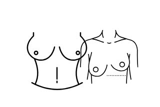 deux silhouettes de femmes avec deux formes de seins différents 