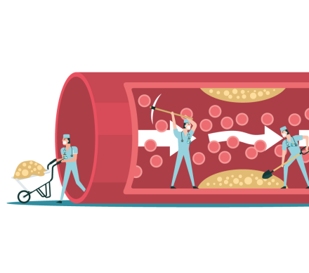 Prévention des troubles lipidiques