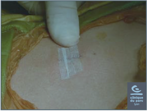 abords mini invasifs chirurgie clinique du parc lyon