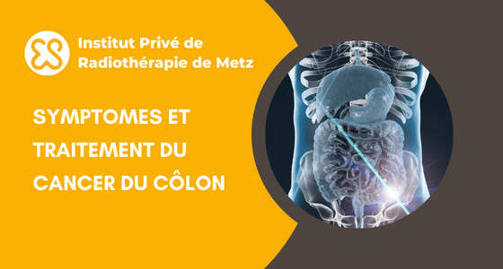 symptome cancer colon
