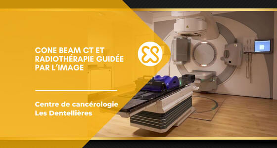 Cone beam CT et radiothérapie guidée par l'image