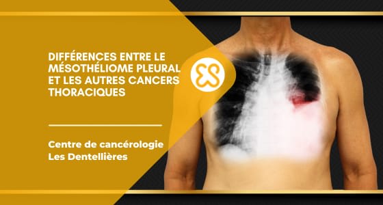Différences entre mésothéliome pleural et autres cancers thoraciques