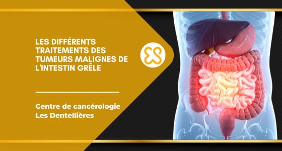 Différents traitements des tumeurs malignes de l'intestin grèle