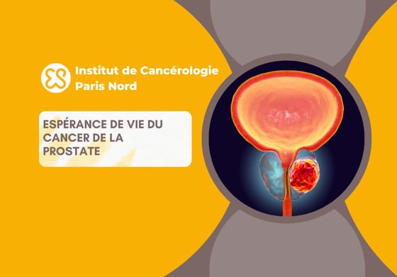 Espérance de vie du cancer de la prostate