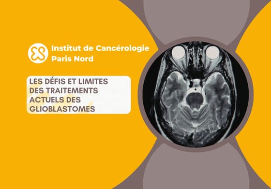 Défis et limites des traitements du glioblastome
