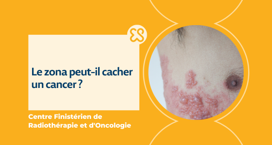 Le zona peut-il cacher un cancer