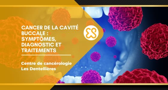 Cancer de la cavité buccale - Symptômes, diagnotcis et traitements