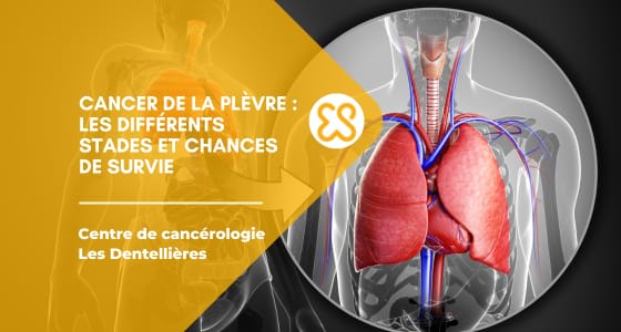 Cancer de la plèvre : Les différents stades et chances de survie