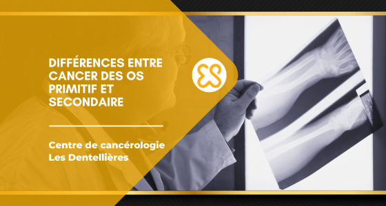 Différences entre cancer des os primitif et secondaire