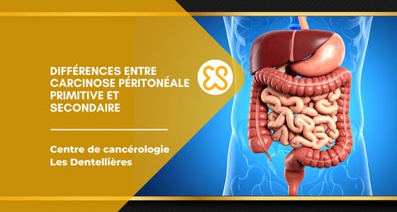 Différences entre carcinose péritonéale primitive et secondaire