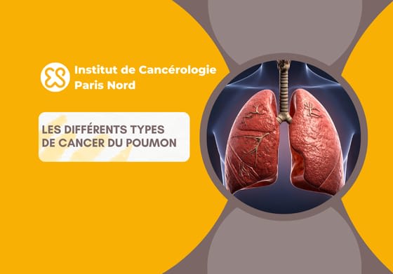 Les différents types de cancer du poumon