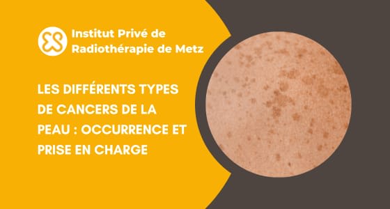 Les différents types de cancers de la peau