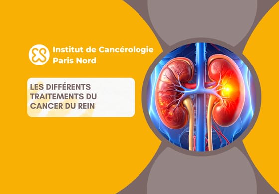 Les différents traitements du cancer du rein