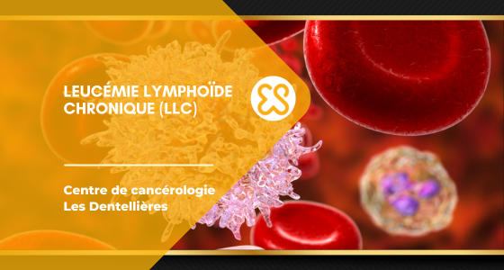Leucémie lymphoïde chronique (LLC)