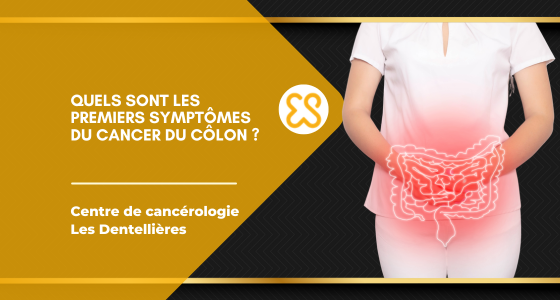 symptomes cancer colon